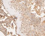 HDAC10 Antibody in Immunohistochemistry (Paraffin) (IHC (P))