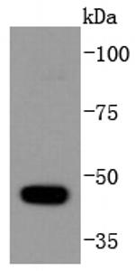 HDAC10 Antibody in Western Blot (WB)