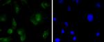 SOX11 Antibody in Immunocytochemistry (ICC/IF)