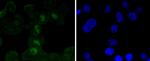 SOX11 Antibody in Immunocytochemistry (ICC/IF)