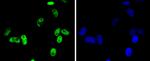 CDK9 Antibody in Immunocytochemistry (ICC/IF)