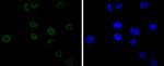 CDK9 Antibody in Immunocytochemistry (ICC/IF)