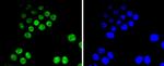 CDK9 Antibody in Immunocytochemistry (ICC/IF)