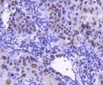 CDK9 Antibody in Immunohistochemistry (Paraffin) (IHC (P))