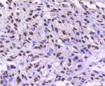 CDK9 Antibody in Immunohistochemistry (Paraffin) (IHC (P))