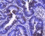 CDK9 Antibody in Immunohistochemistry (Paraffin) (IHC (P))