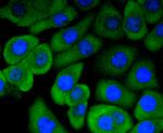 RON Antibody in Immunocytochemistry (ICC/IF)