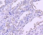 RON Antibody in Immunohistochemistry (Paraffin) (IHC (P))