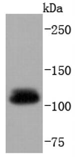 UBE1 Antibody in Western Blot (WB)