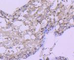 HSP105 Antibody in Immunohistochemistry (Paraffin) (IHC (P))