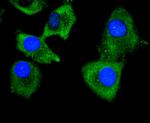 Collagen VI Antibody in Immunocytochemistry (ICC/IF)