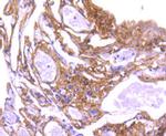 Collagen VI Antibody in Immunohistochemistry (Paraffin) (IHC (P))