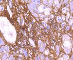 Collagen VI Antibody in Immunohistochemistry (Paraffin) (IHC (P))