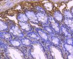 Collagen VI Antibody in Immunohistochemistry (Paraffin) (IHC (P))