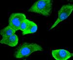 Cdc34 Antibody in Immunocytochemistry (ICC/IF)