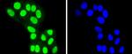 HDAC8 Antibody in Immunocytochemistry (ICC/IF)