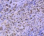 HDAC8 Antibody in Immunohistochemistry (Paraffin) (IHC (P))