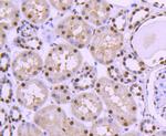 HDAC8 Antibody in Immunohistochemistry (Paraffin) (IHC (P))