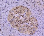 HDAC8 Antibody in Immunohistochemistry (Paraffin) (IHC (P))