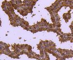 Cdc37 Antibody in Immunohistochemistry (Paraffin) (IHC (P))