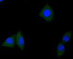 TrkA/TrkB/TrkC Antibody in Immunocytochemistry (ICC/IF)