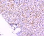 TrkA/TrkB/TrkC Antibody in Immunohistochemistry (Paraffin) (IHC (P))