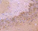 TrkA/TrkB/TrkC Antibody in Immunohistochemistry (Paraffin) (IHC (P))