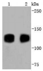 TrkA/TrkB/TrkC Antibody in Western Blot (WB)