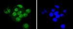 SUMO2/SUMO3 Antibody in Immunocytochemistry (ICC/IF)