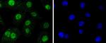 SUMO2/SUMO3 Antibody in Immunocytochemistry (ICC/IF)