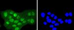 SUMO2/SUMO3 Antibody in Immunocytochemistry (ICC/IF)