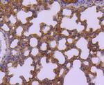 SUMO2/SUMO3 Antibody in Immunohistochemistry (Paraffin) (IHC (P))