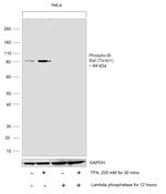 Phospho-B-Raf (Thr401) Antibody