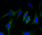 CD36 Antibody in Immunocytochemistry (ICC/IF)