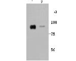 CD36 Antibody in Western Blot (WB)