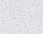 SOX1 Antibody in Immunohistochemistry (Paraffin) (IHC (P))