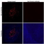 PD-L1 (CD274) Antibody in Immunohistochemistry (Paraffin) (IHC (P))