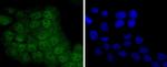 STAT5 alpha/beta Antibody in Immunocytochemistry (ICC/IF)