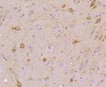 STAT5 alpha/beta Antibody in Immunohistochemistry (Paraffin) (IHC (P))