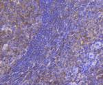 STAT5 alpha/beta Antibody in Immunohistochemistry (Paraffin) (IHC (P))