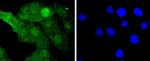 MEK3/MEK6 Antibody in Immunocytochemistry (ICC/IF)