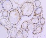 PAX8 Antibody in Immunohistochemistry (Paraffin) (IHC (P))