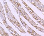 SOD2 (MnSOD) Antibody in Immunohistochemistry (Paraffin) (IHC (P))