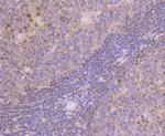 MGMT Antibody in Immunohistochemistry (Paraffin) (IHC (P))