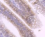 MGMT Antibody in Immunohistochemistry (Paraffin) (IHC (P))