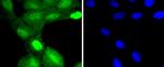 TSG101 Antibody in Immunocytochemistry (ICC/IF)