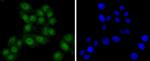 TSG101 Antibody in Immunocytochemistry (ICC/IF)