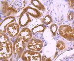 TSG101 Antibody in Immunohistochemistry (Paraffin) (IHC (P))