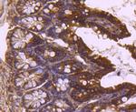 TSG101 Antibody in Immunohistochemistry (Paraffin) (IHC (P))