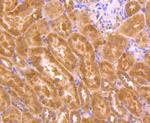 TSG101 Antibody in Immunohistochemistry (Paraffin) (IHC (P))